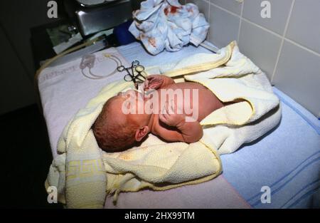 baby after birth in hospital, perinatal Stock Photo