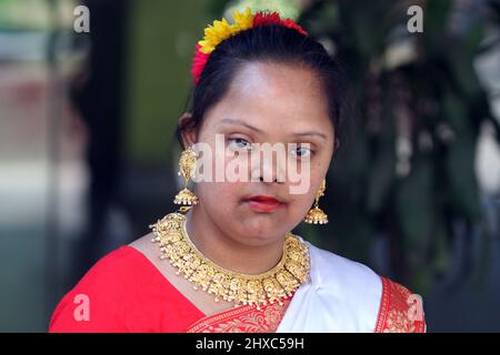 Dhaka, Bangladesh - March 21, 2015: Down syndrome girl in Dhaka, Bangladesh. Stock Photo