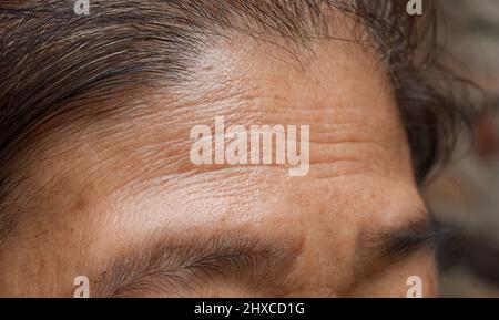 Skin creases or wrinkles at oily forehead of Southeast Asian, Myanmar or Burmese elder woman. Symptom of aging. Stock Photo