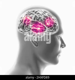 Human brain and man face, side view. X-rays. Degenerative disease, synapses and neurons, brain functioning. Stroke and cognitive problems. Parkinson Stock Photo