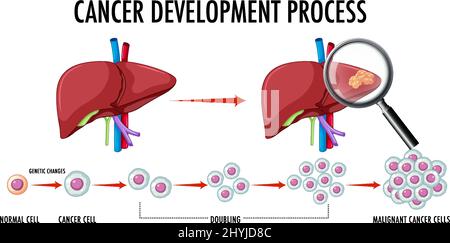 Diagram showing cancer development process illustration Stock Vector