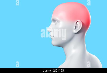 3d render artwork illustration of male gray colored figure with head pain on blue background. Stock Photo