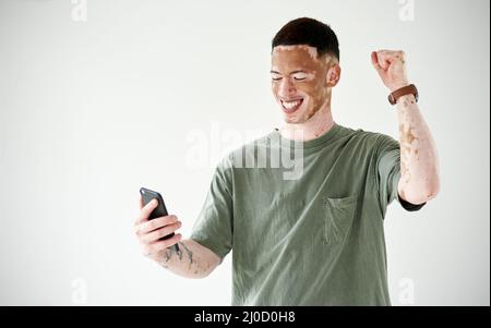 Oh yeah, I won. Studio shot of a young man with vitiligo cheering while using a cellphone against a white background. Stock Photo
