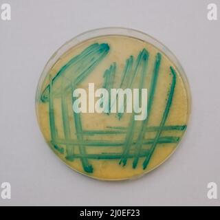 photo of growth of green bacterial colonies on nutrient agar Stock Photo