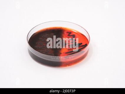 photo of growth of black bacterial colonies on macconkey agar Stock Photo
