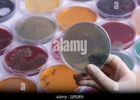 collection of culture plates contain growth of microorganisms on different agar media Stock Photo