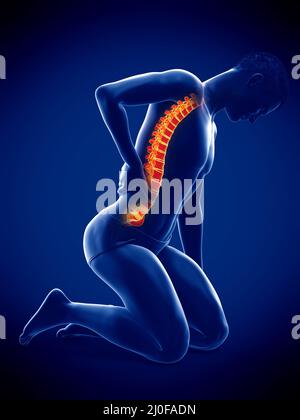 Man with acute back pain, illustration Stock Photo - Alamy