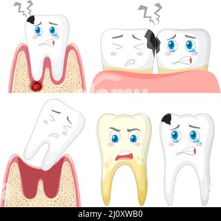 Set of teeth decay on white background illustration Stock Vector