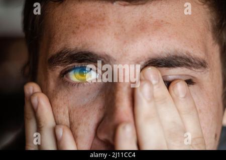 The young European brunet guy covered his face with his hands. Flag in eyes. Tired and desperate person. War between Russia and Ukraine. Basic Stock Photo