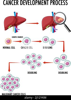 Diagram showing cancer development process illustration Stock Vector