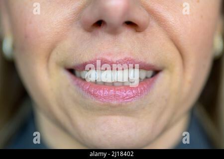 Close up on the smiling mouth and teeth of a mature woman Stock Photo