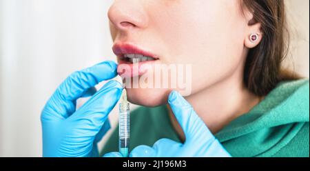 Lips injection. Facial rejuvenation with cosmetic hyaluronic filler. Lip augmentation and correction procedure. Stock Photo