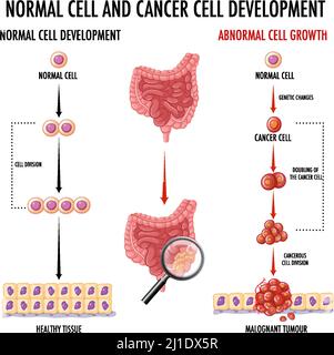 Diagram showing normal and cancer cell illustration Stock Vector