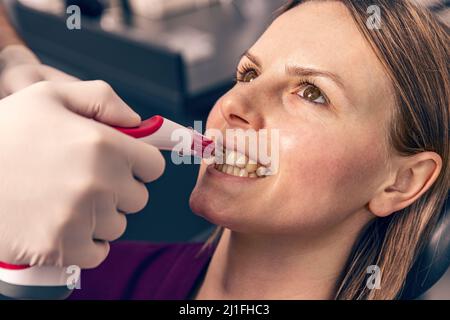 Dentist matching teeth color of woman with digital shade guide teeth color comparator Stock Photo