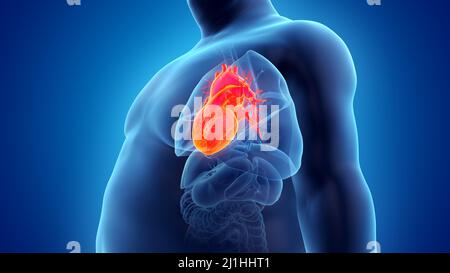 Obese man's heart, illustration Stock Photo