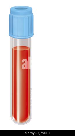 Test tube + blood Stock Photo