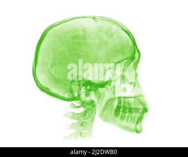 Human skull. Green X-ray image isolated on white background Stock Photo