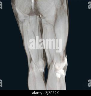 Muscle, scan Stock Photo