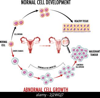 Diagram showing normal and cancer cells illustration Stock Vector Image ...