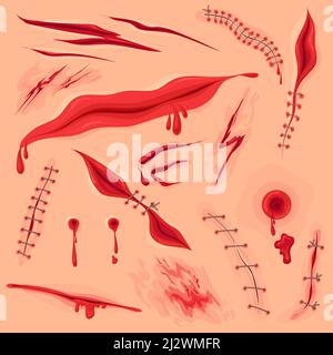 Skin incision wound. Bloody surgery stitch scar or cut on body, lacerated wounded texture, injured skins red mark pain gash hurt halloween horror, cartoon neat vector illustration Stock Vector