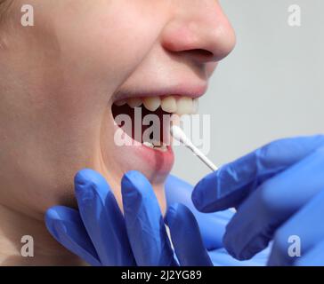 doctor with latex glove carries out an oropharyngeal swab to search for the Covid-19 virus and the girl with mouth open Stock Photo