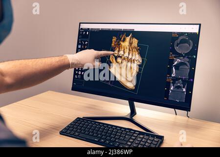 Hands doctor dentist in gloves show the teeth on x-ray on digital screen in dental clinic. Healthy teeth concept Stock Photo