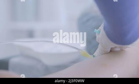 Medic puts IV. Action. Close-up of doctor's hands inserting dropper into veins. Intravenous drip Stock Photo