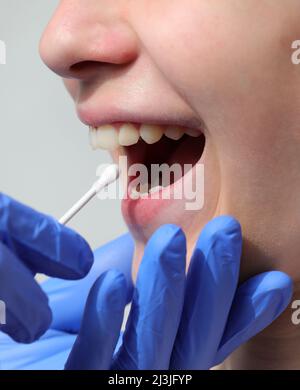 doctor with latex glove carries out an oropharyngeal swab to search for the Covid-19 virus and the girl with her mouth open Stock Photo