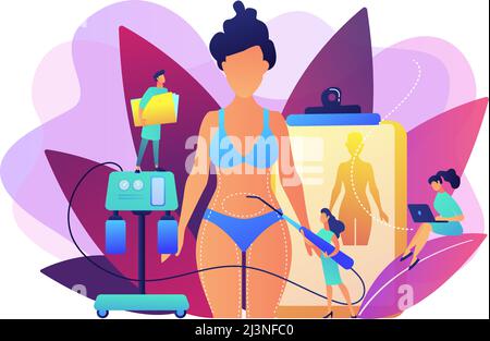 Plastic surgeon with a suction tube doing liposuction of woman marked body parts. Liposuction, lipo procedure, fat removal surgery concept. Bright vib Stock Vector
