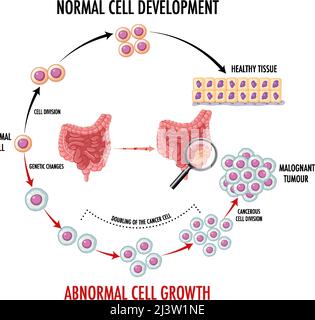 Diagram showing cancer development process illustration Stock Vector