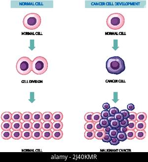 Process of cancer cell development illustration Stock Vector