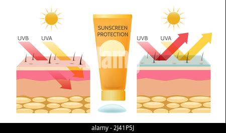 Sun Exposure Concept. Uva And Uvb Rays Penetrates Into Dermis And 