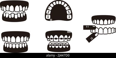 Teeth braces icons, Vector flat illustration Stock Vector