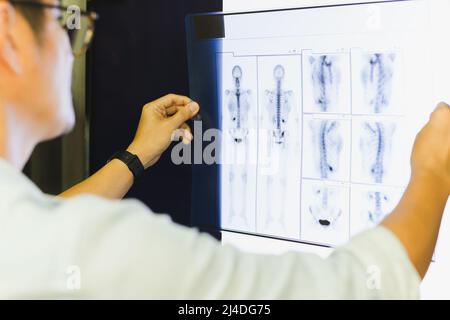 Side view of medical doctor looking at human x-ray. Stock Photo