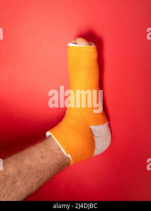 File:Broken right hand in orange cast.jpg - Wikipedia