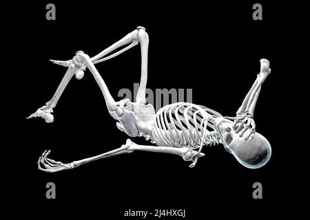Human skeleton in pain, conceptual illustration Stock Photo
