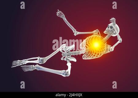 Human skeleton in a painful position, conceptual illustration Stock Photo