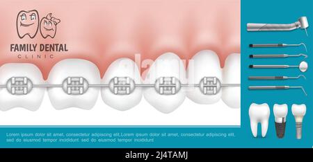 Realistic dentistry and stomatology composition with metal braces on teeth stomatological medical instruments and dental implants vector illustration Stock Vector