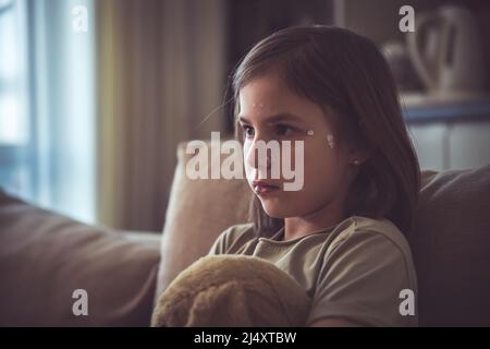 Cute little girl with chickenpox at home. Varicella zoster virus. Stock Photo