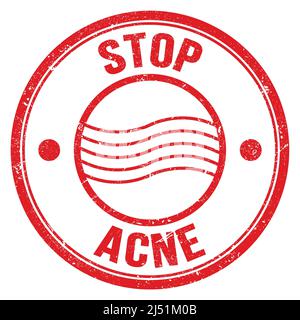 STOP ACNE text written on red round postal stamp sign Stock Photo