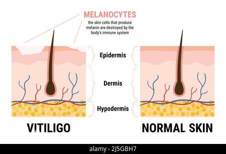 Hair cell melanin Stock Vector Images - Alamy