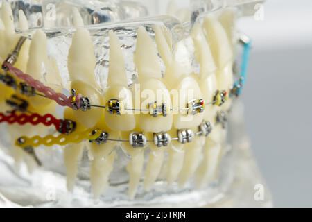 Mould of human teeth close up. dental gypsum model. Plaster cast human jaws prosthetic laboratory. Dentistry teeth care imag Stock Photo