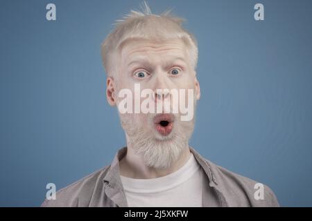 Portrait of shocked bearded albino guy looking at camera with eyes and mouth wide open showing amazement Stock Photo