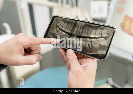 Dentist examining x-ray image on mobile phone Stock Photo