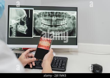 Dentist with mobile phone examining x-ray image on computer at dental clinic Stock Photo