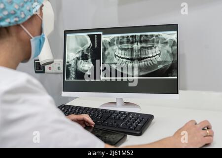 Dentist examining x-ray image on computer at medical clinic Stock Photo