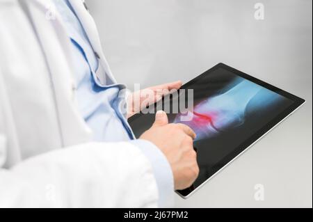 Unrecognizable Doctor is checking x-ray image at computer tablet, close up. Doctor at work in a hospital. Medicine and healthcare concept. High quality photography. Stock Photo