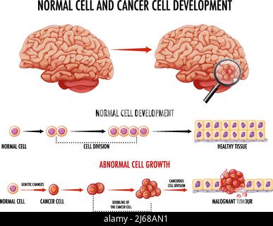 Diagram showing normal and cancer cell illustration Stock Vector Image ...