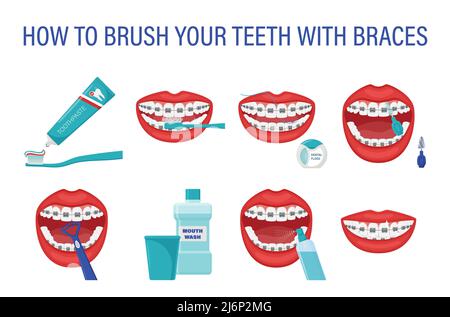 Infographic How To Brush Your Teeth. Step-by-step Instructions. Oral ...