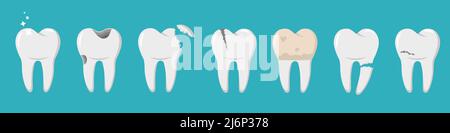 A set of human teeth with different injuries. Healthy and diseased tooth, caries, broken root, plaque, spots, crack. Banner, poster for printing. Info Stock Vector